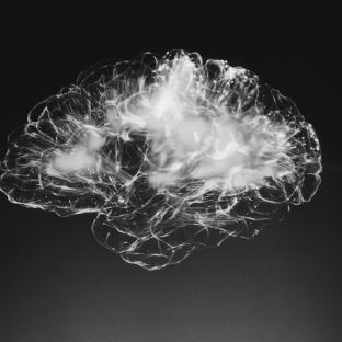 Vascular dementia