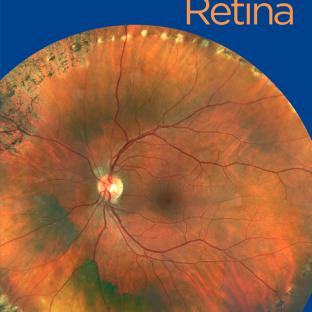 Ophthalmology Retina