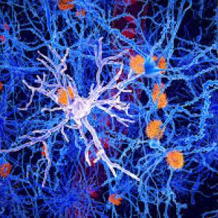 microglia
